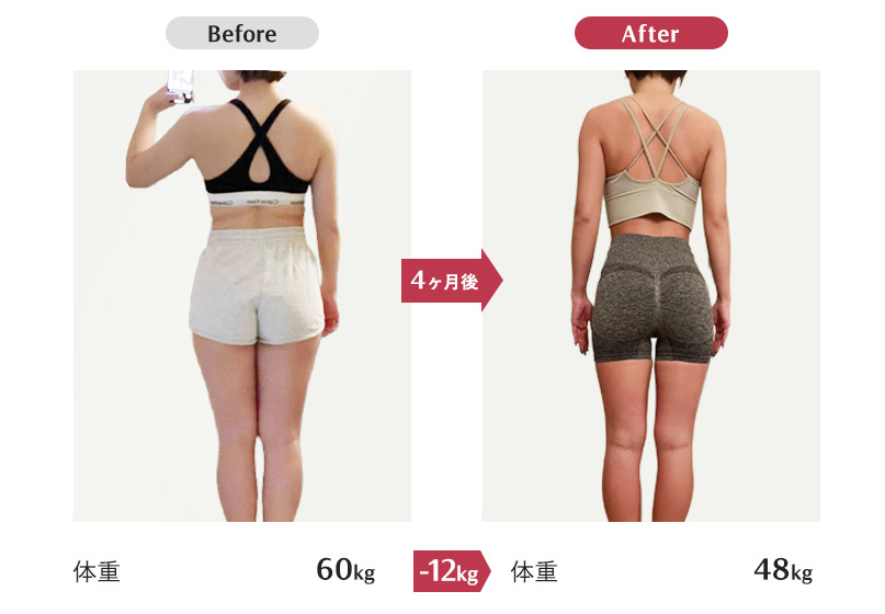 Tさん　27歳女性│身長160cm