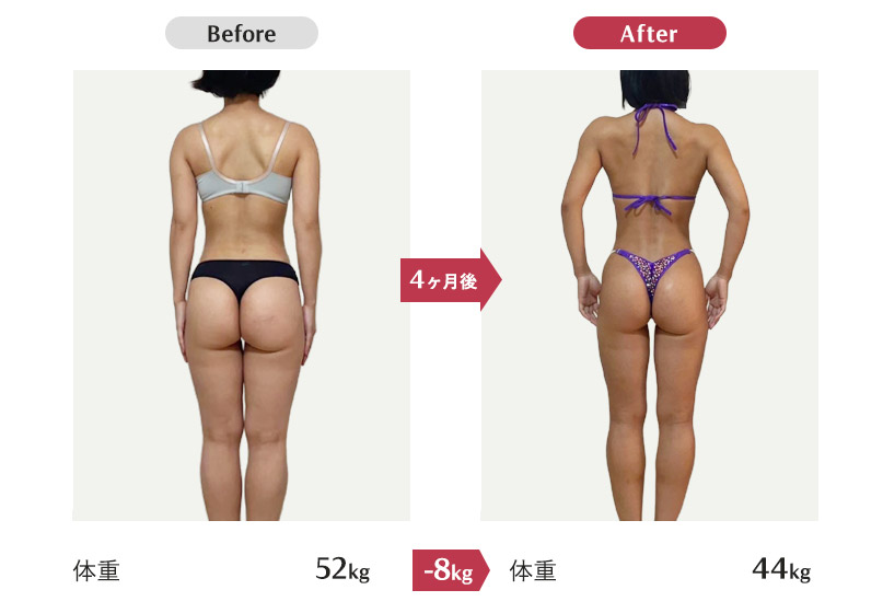 Oさん　29歳女性│身長155cm